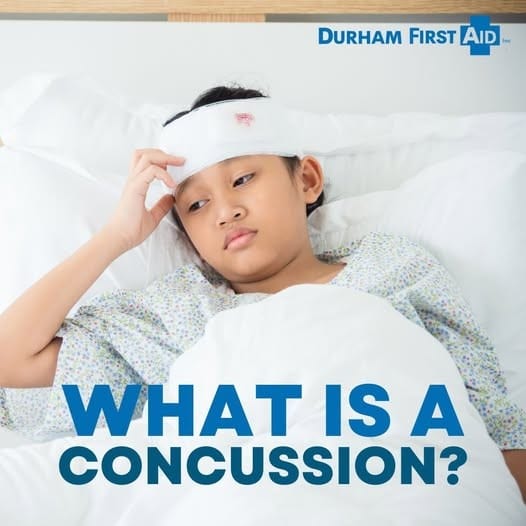 What is a concussion
